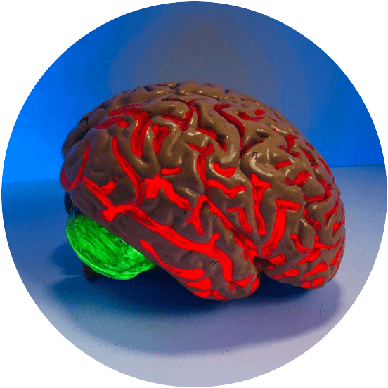 Blood Vessels - In Brain