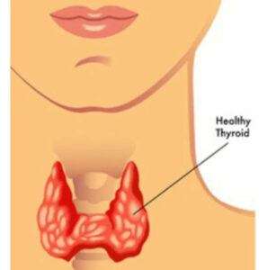 DIAGRAM POINTING TO THYROID SYMPTOMS IN WOMENDIAGRAM SHOWING WHERE THE THYROID GLAD IS LOCATED.