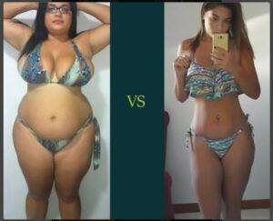 BEFORE AND AFTER PHOTOS OF A YOUNG LADY WHO HAD BARIATRIC SURGERY