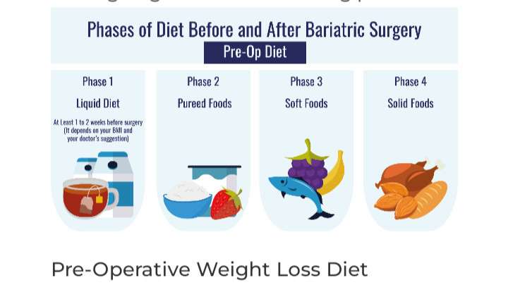 PRE-OPERATIVE WEIGHT LOSS DIET - THIS IS DONE PRIOR TO BARIATRIC SURGERY