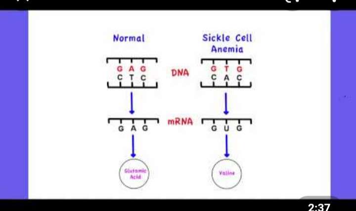 SICKLE CELL ANEMIA DIAGRAM