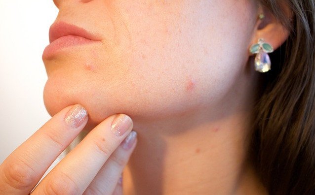 HOW HORMONAL CHANGES AGFFECT WEIGHT LOSS - HEADSHOT OF A WOMENHOLDING HER CHIN CLOSE TO THE THYROID HORMONAL GLANDS