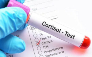 DIAGRAM OF SPECIALIST WITH A VIAL THAT READA CORTISOL TEST