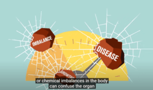 ILLUSTRATION SHOWS A CHEMICAL IMBALANCE IN THE BODY EQUALS DISEASE SHOWN AS TWO BROWN ROUND ELEMENTS WITH BACKFROUND IN YELLOW TAN AND LIGHT BLUE SIMILAR TO A SPIDER WEB 