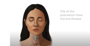 ILLUSTRATION SHOWSMTHAT 12% OF POPULATION SUFFER FROM THYROID ISSUES