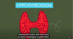 diagram explaining the thyroid gland