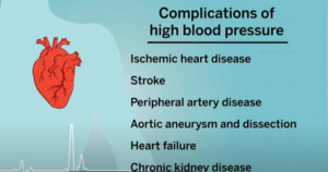 ILLUSTRATIONS EXPLAINS THE DANGER OF HAVING HIGH BLOOD PRESSURE