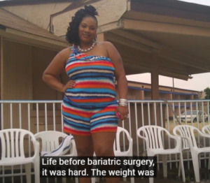 WHICH WEIGHT LOSS SURGERY IS SAFEST